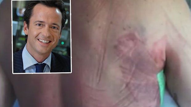 Article image for Hamish McLachlan recovers in hospital after being trampled by horse