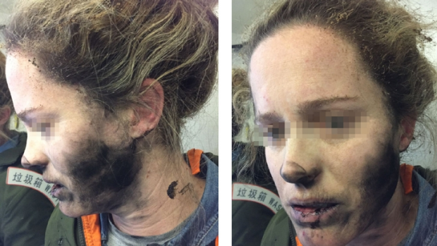 Article image for Melbourne woman’s headphones explode mid-flight