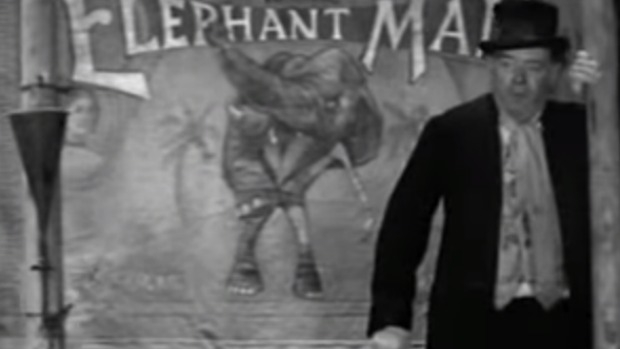 Article image for Sherlock’s Classics: Film Review – The Elephant Man (1980)