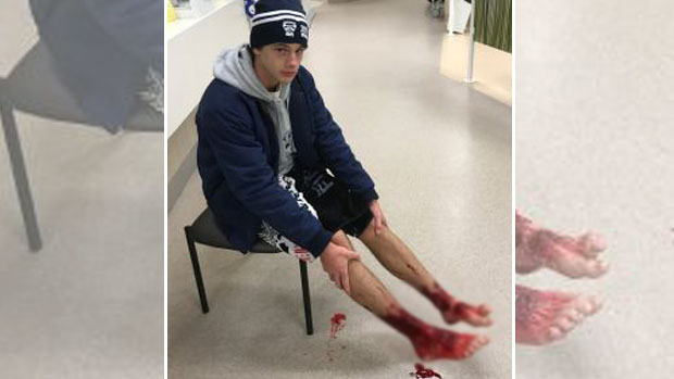 Article image for Teen left bleeding profusely after quick dip at Brighton