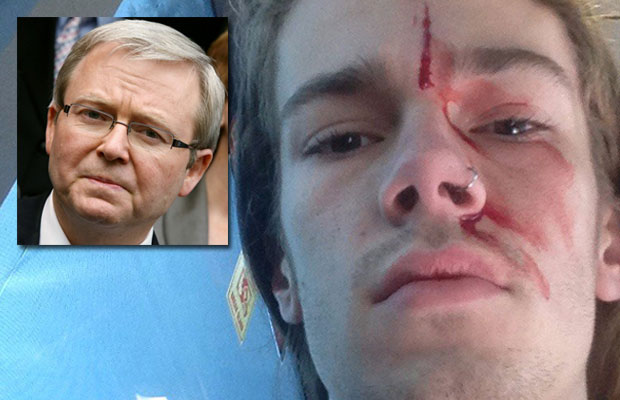 Article image for Former Prime Minister’s godson attacked ‘standing up’ for marriage equality