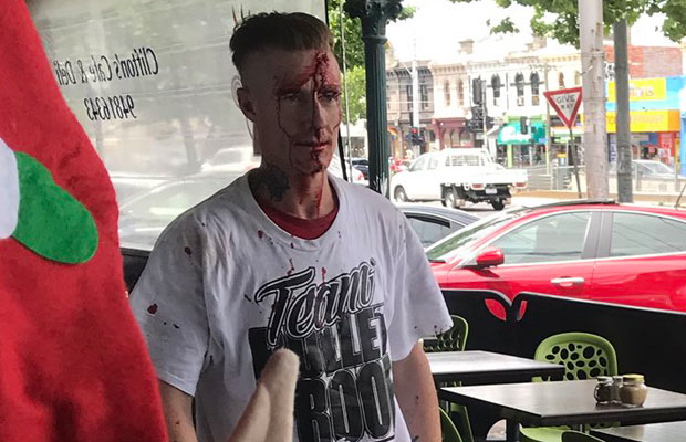 Article image for Bloody fight erupts at Clifton Hill cafe