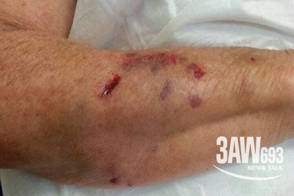Article image for Grandmother attacked by dog in Geelong, owner simply walks away