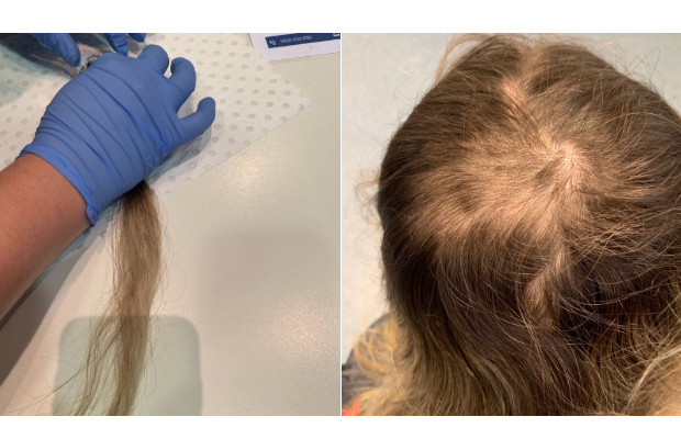 Article image for ‘Butchering their hair’: Paramedics feel violated after ‘barbaric’ drug testing process