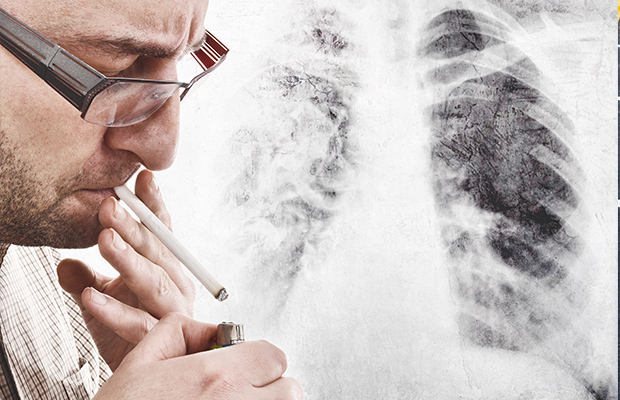 Article image for CT scans spearhead new plan to detect lung cancer early