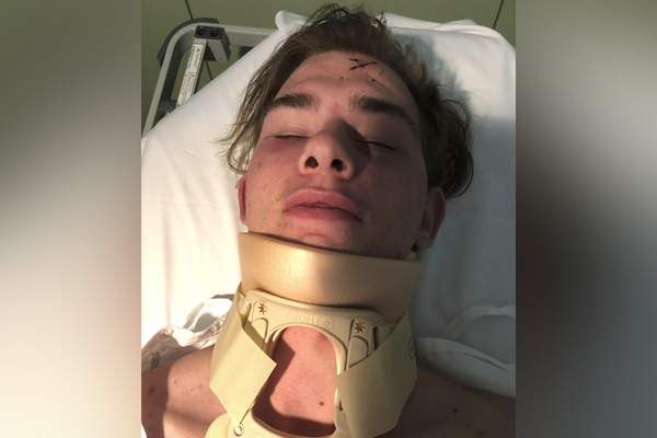 Article image for Autistic teenager badly bashed by gang in Melbourne’s west for a second time
