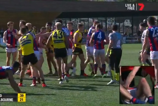Article image for Father speaks out following ugly hit in the VFL