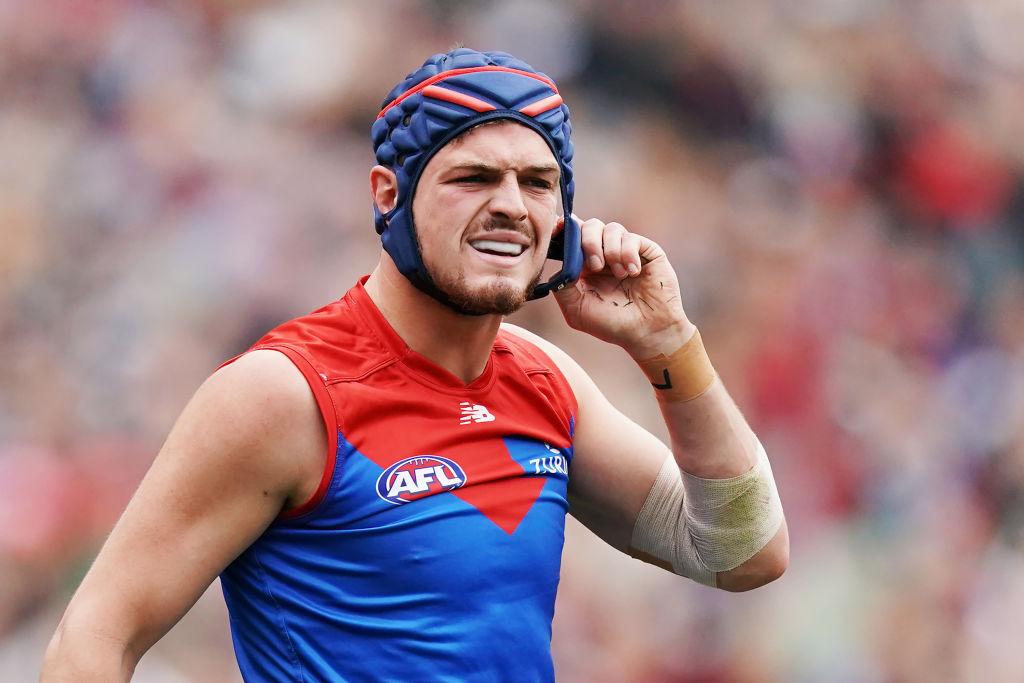 Article image for Concussion in the AFL: Should headgear be compulsory?