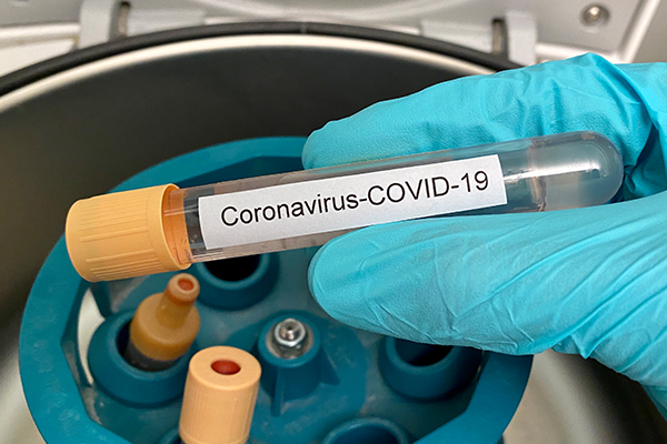 Article image for Game-changing COVID-19 test on its way to Australia