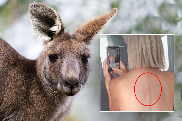 Article image for The bizarre reason a ranger thinks a kangaroo attacked a jogger