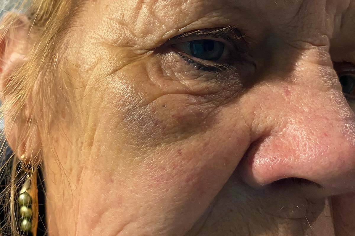 Article image for Woman, 79, punched in the face in deplorable Dandenong attack