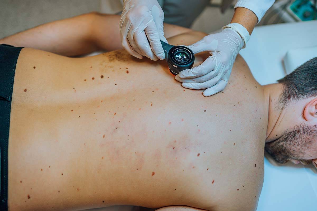 Article image for Cancer fears after Victorian diagnoses dip