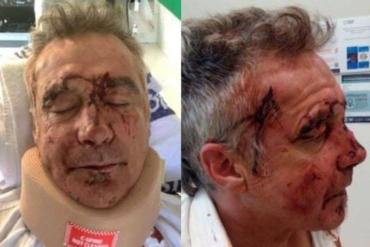 Article image for Man bashed in vicious bus assault in Beaconsfield