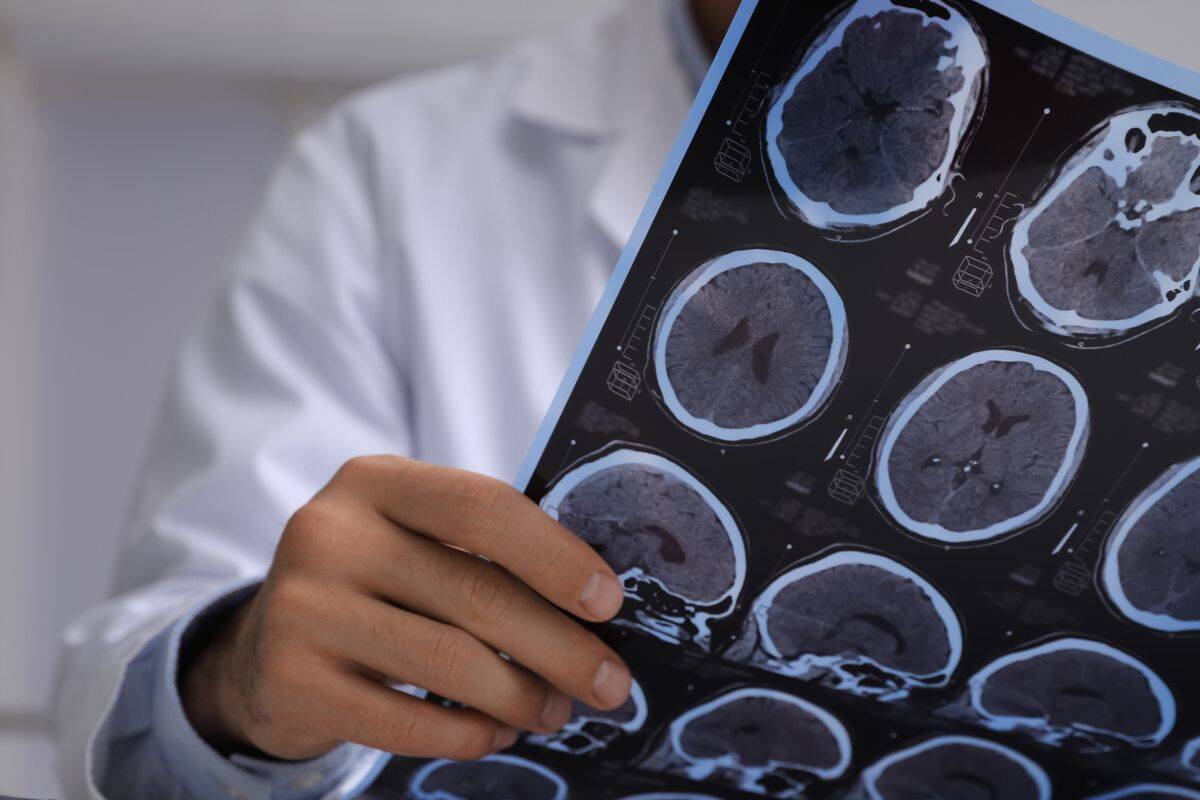 Article image for How the AIS is aiming to improve the ‘long-term brain health’ of people in sport