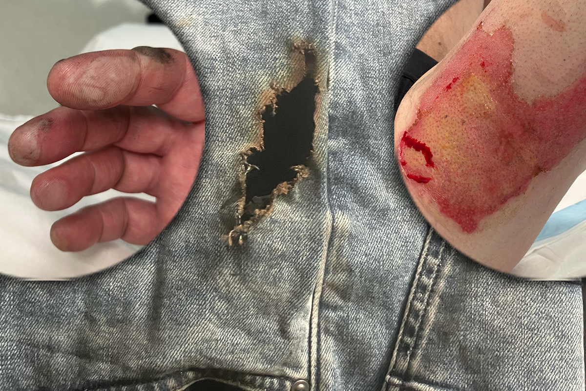 Article image for How a man suffered serious burns at Melbourne Airport
