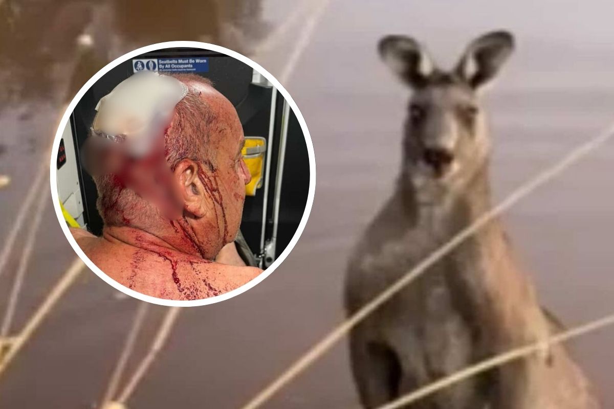 Article image for ‘I am very lucky’: Man speaks out after near-death experience with kangaroo